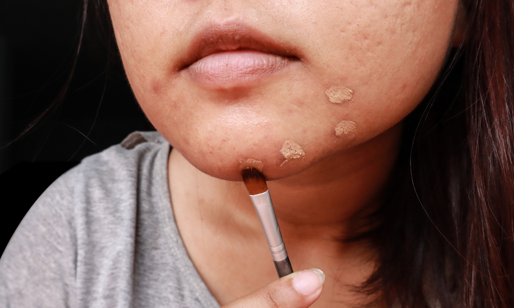 Make-up tips voor de eczeemgevoelige huid