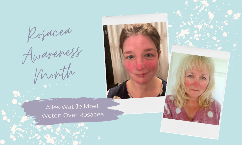 Rosacea Awareness Month: Alles Wat Je Moet Weten Over Rosacea