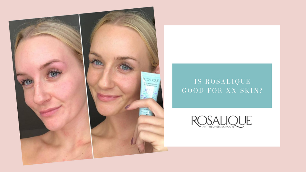 Voor welke huidtypes of -tinten is Rosalique geschikt?