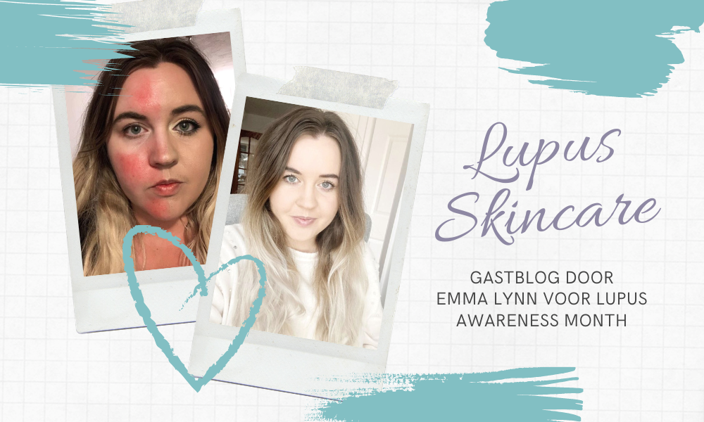 Lupus Skincare Tips door Emma Lynn – Lupus Awareness Month