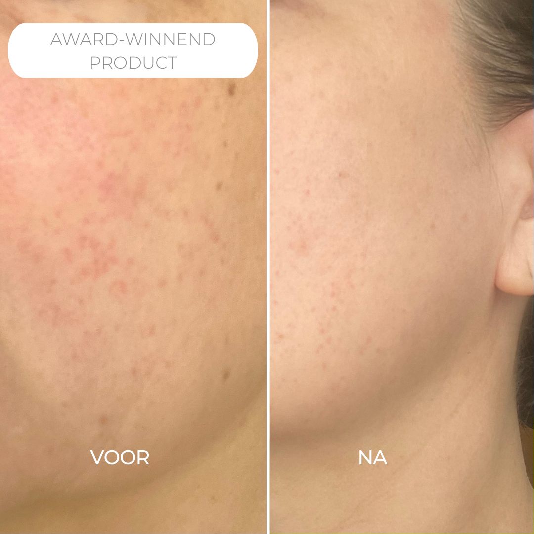 Rosalique Ultimate Cream Duo